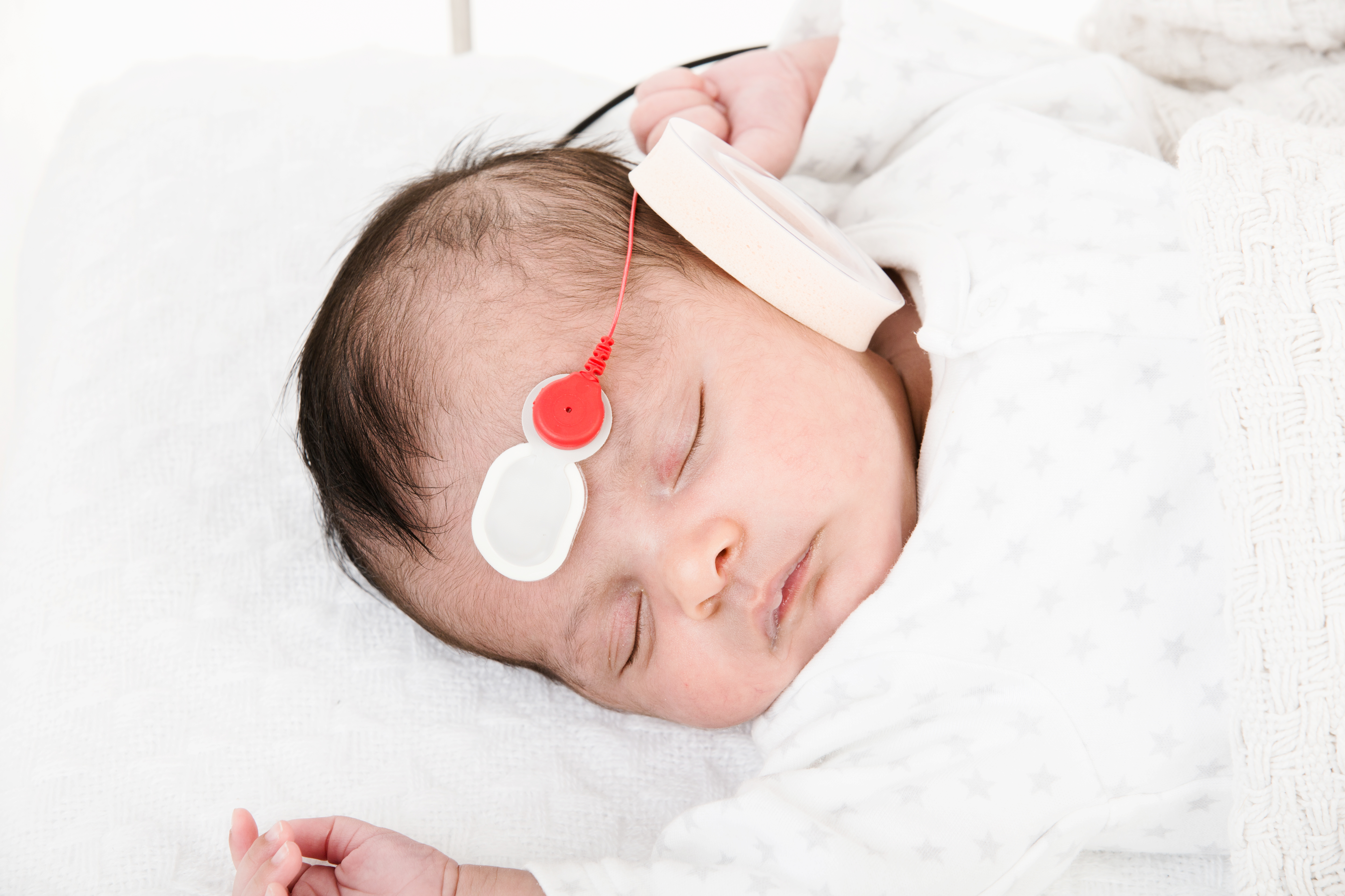 OtoNova with Earcup Electrode for Paediatrics